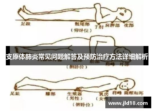 支原体肺炎常见问题解答及预防治疗方法详细解析
